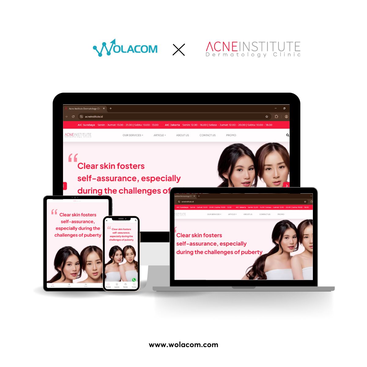 Acne Institute Clinic, Solusi Terpadu Atasi Jerawat dan Bekasnya di Jakarta & Surabaya